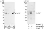eIF3F Antibody in Western Blot (WB)