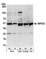 SMYD2 Polyclonal Antibody