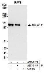 Caskin 2 Antibody in Immunoprecipitation (IP)