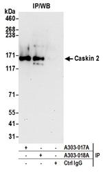 Caskin 2 Antibody in Immunoprecipitation (IP)