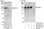 TANC1 Polyclonal Antibody