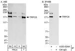 TRPC6 Polyclonal Antibody
