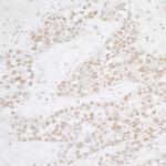 ATF1 Polyclonal Antibody