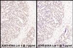 ATF1 Polyclonal Antibody