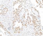 RFX1 Antibody in Immunohistochemistry (Paraffin) (IHC (P))