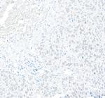 RFX1 Antibody in Immunohistochemistry (Paraffin) (IHC (P))