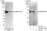 p49/STRAP Antibody in Western Blot (WB)