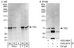 TR2 Polyclonal Antibody