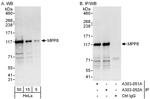 MPP8 Polyclonal Antibody