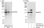 MPP8 Polyclonal Antibody
