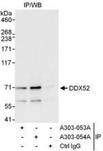 DDX52 Polyclonal Antibody