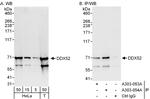DDX52 Polyclonal Antibody
