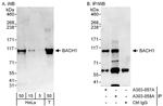 BACH1 Polyclonal Antibody