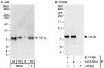 TIF-IA Polyclonal Antibody