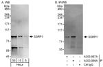 SSRP1 Antibody in Western Blot (WB)