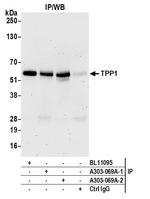 TPP1 Antibody in Immunoprecipitation (IP)