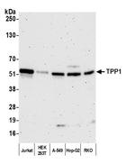 TPP1 Polyclonal Antibody