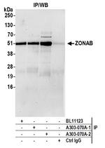 ZONAB Antibody in Immunoprecipitation (IP)