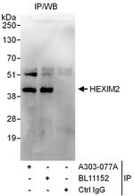 HEXIM2 Polyclonal Antibody