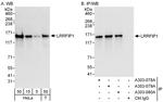 LRRFIP1 Polyclonal Antibody