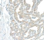 EBP1 Polyclonal Antibody