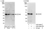 ZC3H8 Polyclonal Antibody