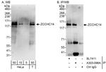 ZCCHC14 Polyclonal Antibody