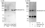 ARHGAP11A Polyclonal Antibody