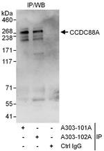 CCDC88A Polyclonal Antibody