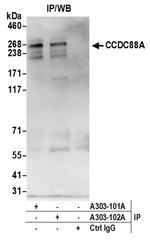CCDC88A Antibody in Immunoprecipitation (IP)