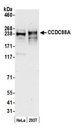 CCDC88A Polyclonal Antibody