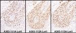 HEXIM1 Polyclonal Antibody