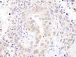 HEXIM1 Antibody in Immunohistochemistry (Paraffin) (IHC (P))