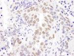 HEXIM1 Antibody in Immunohistochemistry (Paraffin) (IHC (P))