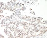 NF110 Polyclonal Antibody