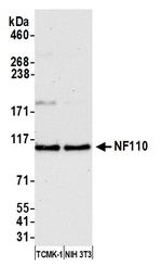 NF110 Antibody in Western Blot (WB)