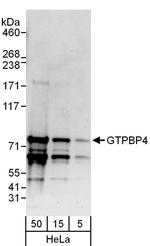 GTPBP4 Polyclonal Antibody