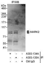 MARK2 Polyclonal Antibody