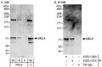 MELK Antibody in Western Blot (WB)