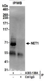 NET1 Antibody in Immunoprecipitation (IP)