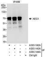 AEG1 Polyclonal Antibody