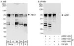 AEG1 Polyclonal Antibody