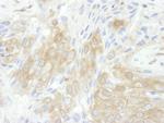 14-3-3 theta Polyclonal Antibody