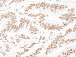 NF45 Antibody in Immunohistochemistry (Paraffin) (IHC (P))