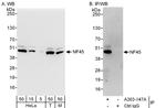 NF45 Antibody in Western Blot (WB)