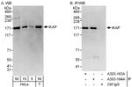 IKAP Polyclonal Antibody