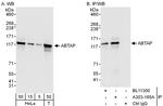 ABTAP Polyclonal Antibody
