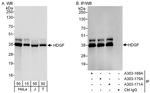 HDGF Antibody in Western Blot (WB)