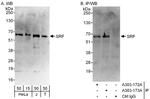 SRF Antibody in Western Blot (WB)