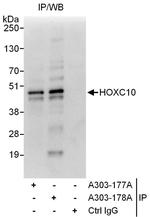 HOXC10 Polyclonal Antibody